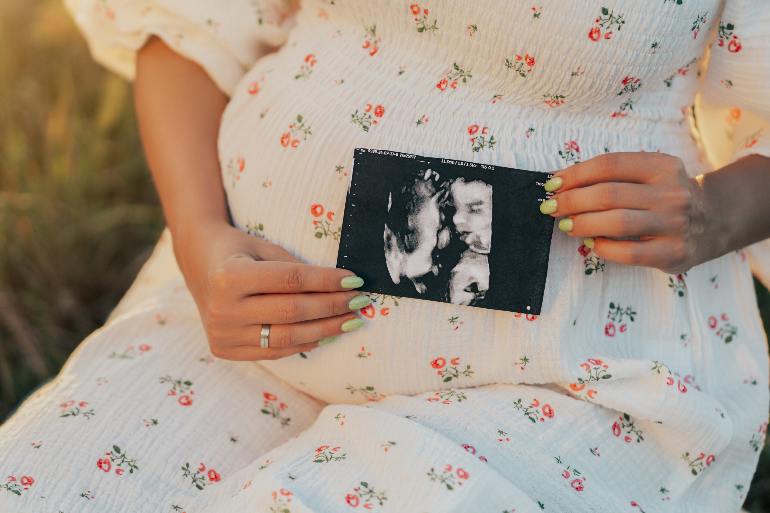 Woman in a white dress with red flowers holding a baby ultrasound picture in front of her pregnant belly